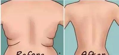 哪个明星后背烫伤过,揭秘XXX背后不为人知的烫伤往事